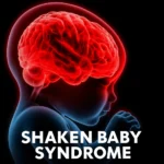 Growing Doubts in Shaken Baby Syndrome Cases as Experts Question Old Science