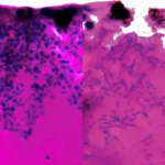 Scientists find a weak spot in deadly fungus that shut down hospital intensive care units