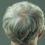 We may finally have a way to reverse grey hair