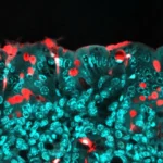 This common food ingredient may shape a child’s health for life