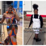 How this mom rose above limb differences through modeling: ‘Fashion became therapeutic’