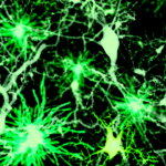 The Science Behind Better Visualizing Brain Function