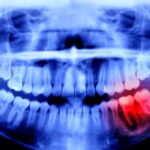 Humans May Be Able to Grow New Teeth Within Just 4 Years