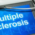 Immunic secures $400M to support late-stage MS trials