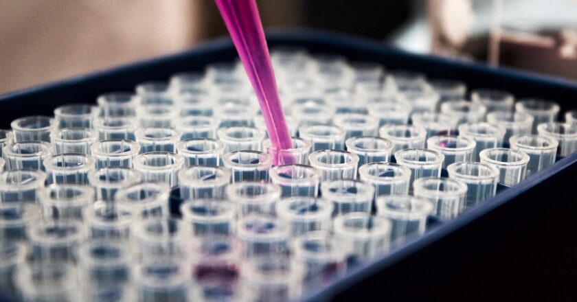 Gut microbes actively support immunity in people living with HIV