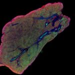 Scientists discover pathway that activates brown fat