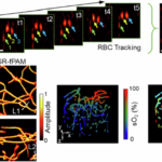 Super-resolution functional photoacoustic microscopy via label-free cell tracking