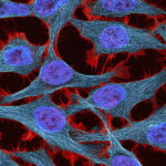 Estate of Henrietta Lacks settles with Novartis over immortal cells