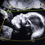 ‘It doesn’t lie. So who are you?’: What happens when DNA tests show a woman is not the mother of the child she gave birth to?