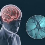 Scientists Call for a Complete Rethink of Alzheimer’s Treatment