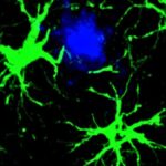 Scientists Cut Amyloid Plaques by 50% in Mice With Engineered Cells : ScienceAlert