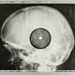 When Soviet Youth Bootlegged Western Rock Music on Discarded X-Rays: Hear Original Audio Samples