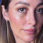 Why I (Almost) Regretted My Lower Blepharoplasty