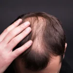 Textbooks were wrong: Scientists reveal the surprising way human hair really grows