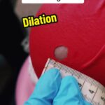 @midwifemamaserena Mr. Owl, how many centimeters does it take for the baby to co…