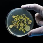 Rise in antibiotic-resistant bacteria poses growing health threat in Greece