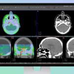 Apple’s Studio Display XDR Supports DICOM Medical Imaging for Diagnostic Radiology