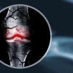 These “forever chemicals” could be weakening kids’ bones for life