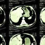 Scientists Finally Uncovered the Story of a 300-Year-Old Mummy