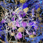 Alzheimer’s may start in body tissue inflammation, not in the brain