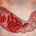 Scientists finally crack mystery of rare COVID vaccine blood clots