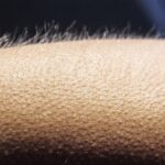 Ever wondered why you get goosebumps? There is hidden science behind it